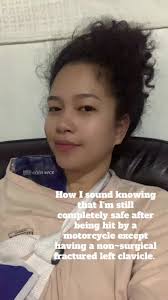 Still pretty and grateful for all things matter✨☺️ #clavicle  #motorcyleaccidentsurvivor #accident #fyp #fyppppppppppppppppppppppp