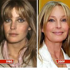 Bo Derek: Good Genes or Good Docs?