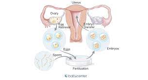 Fertility Treatment In Vitro Fertilization Ivf Babycenter