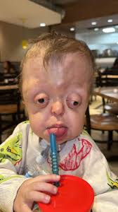 Último rinoceronte blanco, considerado extinto en su hábitat natural. La  actividad humana, la caza furtiva siguen haciendo estragos en la  naturaleza.