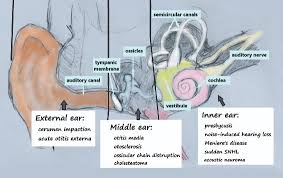 Tinnitus is the disease in which can occur because of the sound of ringing and buzzing in the ear. Hearing Loss Common Causes In Adults And How Nurses Can Help