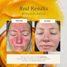 Witness the rejuvenating magic of natural sea berry oil skincare in  Tiffany's luxurious holistic facial at her Madison Crown Skin facial studio  😍 Madison Crown Skin's signature 75-min service showcases Apoterra's  products