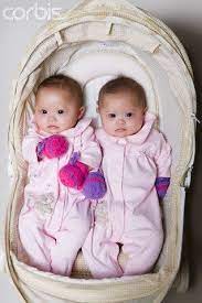 Pin By Whitney On Down Syndrome Developmental And Therapy Ideas Beautiful Babies Cute Twins Beautiful Children