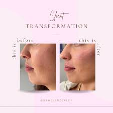 Dr. Helen Eckley Facial Aesthetics