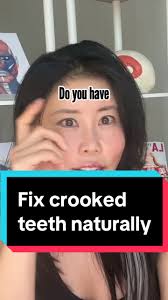 How to Straighten Teeth Naturally at Home