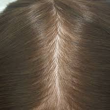 Get the best deals on natural look hair styling products. China Injected Silicone Base Hair Replacement For Men Systems With Natural Look And Top Quality China Hair System And Hair Replacement Price