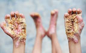 Image result for ‫مریضی های لاعلاج عکس‬‎