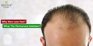 Men with this trait can start to lose their locks as early as their early teens. Why Men Lose Hair What S The Permanent Solution Best Hair Transplant In India Chandigarh Reviva Clinic