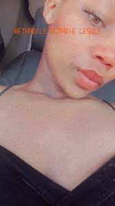 Pregnant and severely sunburned, seeking advice