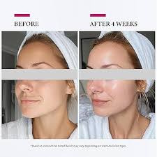 Colorfarm Facial Steamer Nano Ionic: Face Steamer Deep Cleaning Unclogs  Pores