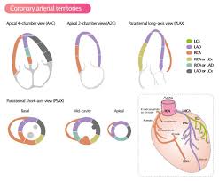Because the rest of the body, and most especially the brain, needs a steady supply of oxygenated blood that is free of all but the slightest interruptions. The Coronary Arteries Ecg Echo