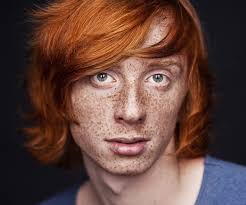 Here you will find diverse content, for all. Redhead Skin Cancer Risk Like Spending 21 Extra Years In Sun