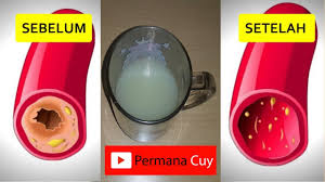 Hasil gambar untuk obat kolesterol ampuh