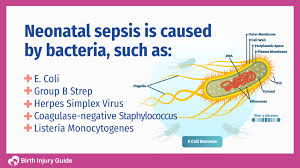 Image result for Neonatal Sepsis