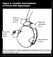 Five common signs of testicular cancer a painless lump, swelling or enlargement of one or both testes. Diagnosis And Emergency Department Management Of Urologic Emergencies In The Male Patient Part I 2002 01 14 Ahc Media Continuing Medical Education Publishing