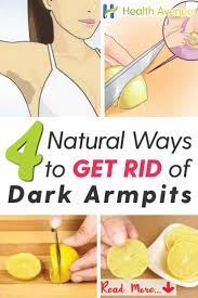 Let S Face It It Can Be Really Embarrassing Here Are 4 Easy And Natural Ways To Get Rid Of Dark Armpits Dark Armpits Dark Underarms Dark Spots Under Armpits