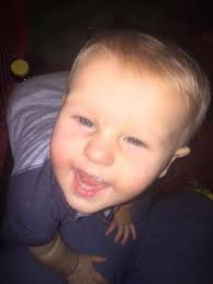 Lily's Lambdoid Craniosynostosis Adventure