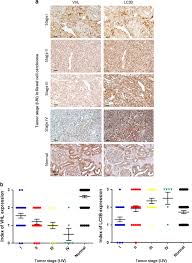 Discover ingrid felipe's biography, age, height, physical. Ubiquitination Of Map1lc3b By Pvhl Is Associated With Autophagy And Cell Death In Renal Cell Carcinoma Cell Death Disease X Mol