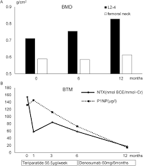 Is new drug prolia (denosumab) better than the rest? A Bone Mineral Density Bmd Bmd In L2 4 Increased By 6 2 After Six Download Scientific Diagram