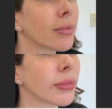 TOP 10 BEST Peptide Therapy in Carlsbad, CA