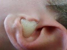 29 Utilisations Magiques De L Eau Oxygenee Ne Ratez Pas La N 23 Eau Oxygenee Nettoyer Les Oreilles Peroxyde D Hydrogene