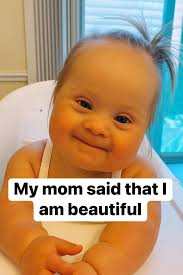 She came into our lives and changed everything. 🌸 Days became brighter,  small gestures gained meaning, and love began to be measured in smiles and  glances that melt any heart. 💕 Many