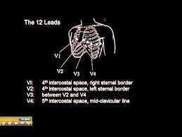 Pediatric Ekg 15 Lead Placement Diagram Wiring Diagrams