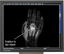 Bei der dauer der eigentlichen untersuchung (ohne vor. Mrt Untersuchungen In Der Radiologie Alta Klinik