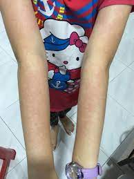 Cara melakukan gerakan ini adalah dengan mengepalkan tangan dan letakkan. Petua Hilangkan Gegata Cerita Budak Sepet