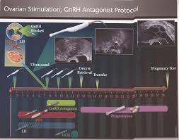 Image result for GnRH Stimulation Test