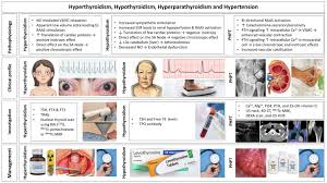 Hypertension in thyroid disease and primary hyperparathyroidism -  ScienceDirect