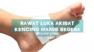 Penggunaan formulasi peria katak hutan ternyata menjadikan produk ini no.1 di malaysia. Sembuhkan Luka Kencing Manis Elak Kaki Dipotong Ohcantik Com