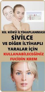 Fucidin Krem Merhem Nedir Ne Ise Yarar Yan Etkileri Ve Kullananlar Krem Cilt Bakimi Recete