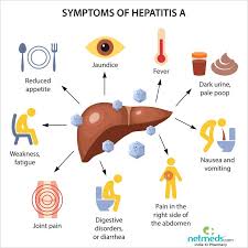 Hepatitis a is a highly contagious liver infection caused by a virus. Hepatitis A Causes Symptoms And Treatment Netmeds