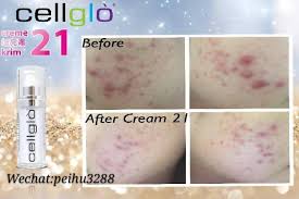 Cellglò creme 21 is designed specifically to purify, nourish, restore and protect your skin consistently and effectively. Cellglo Creme Cellglo Crystal Eyeså…¨é©¬æ€»ä»£ç† æ§ŸåŸŽåŒ—æµ·å¤§å±±è„šé¢äº¤ Facebook