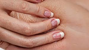 Image result for Akutní zánět nehtového lůžka