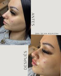 Dra Silvia Aguilera added a new photo.