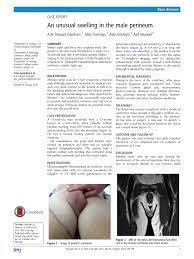PDF) An unusual swelling in the male perineum
