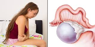 Obat nyeri dada alami dengan qnc jelly gamat hadir sebagai solusi alternatif bagi anda yang kini tengah menderita sakit atau nyeri dada sebelah kiri, kanan, maupun bagian tengah yang menjalar hingga punggung, bahkan di sertai dengan sesak napas sekalipun. Bukan Pms Kram Perut 2 Minggu Setelah Mens Ini Adalah Nyeri Ovulasi Kamu Mengalaminya