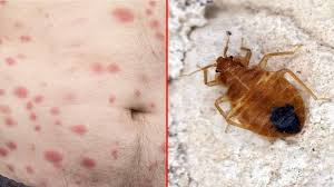 Image result for bed bugs