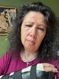 Hello Bow Wow pals…thank you for all your kind words. After my trip and  fall