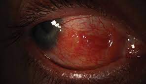 Maybe you would like to learn more about one of these? A Bump In The Road