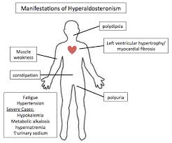 Image result for Hyperaldosteronism