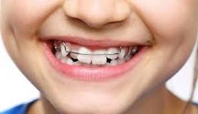 Image result