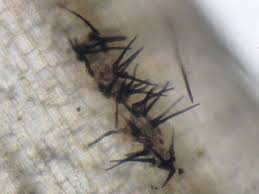 Anthrax is a rare, but serious, infectious disease caused by bacteria known as bacillus anthracis. ç‚­ç–½ç—… æ±æ´‹ã‚°ãƒªãƒ¼ãƒ³æ ªå¼ä¼šç¤¾