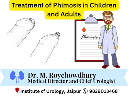 Image result for Phimosis