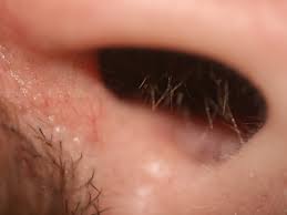 Adult humans have hair in the nostrils. Why Do We Get More Nose Hair As We Get Older Questions Naked Scientists