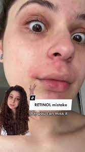 Have you also made this mistake?😩 Tell me I’m not alone🥲  #skincaremistakes #retinolmistakes #skincaretips