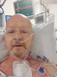 12 hours, 3 days and 7 days pics. 3 day one was a minor blip in HDU so  needed a mask. 2 years