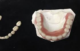 Compared to the perma soft, the prosoft relining is softer, but it will not last as long. Do It Yourself Denture Kit Make Your Own Temporary Image 6 Diy Dentures Denture Affordable Dentures